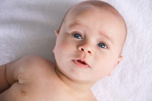 baby with Infant Torticollis