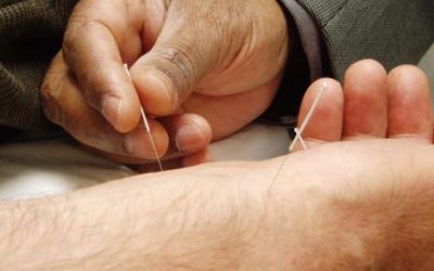Dry Needling: Treatment for Myofascial and Neuromuscular Pain