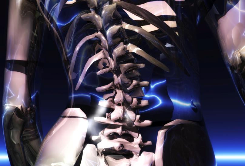Multidisciplinary Team Evaluations Aid in Reducing Spinal Surgeries – Part 2